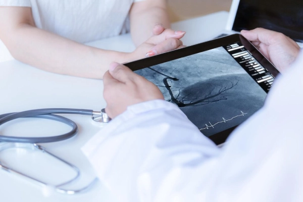 What is a Coronary Angiogram?