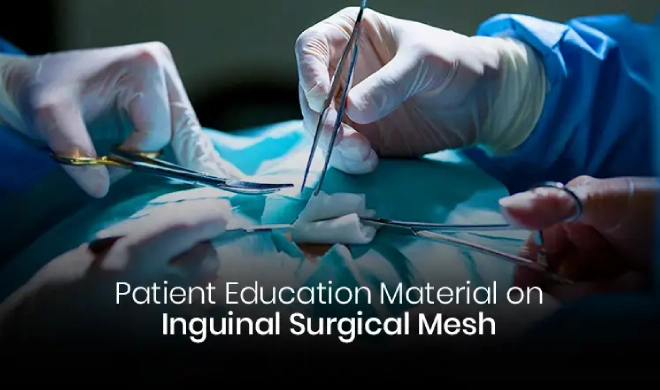 Patient education material on inguinal surgical mesh